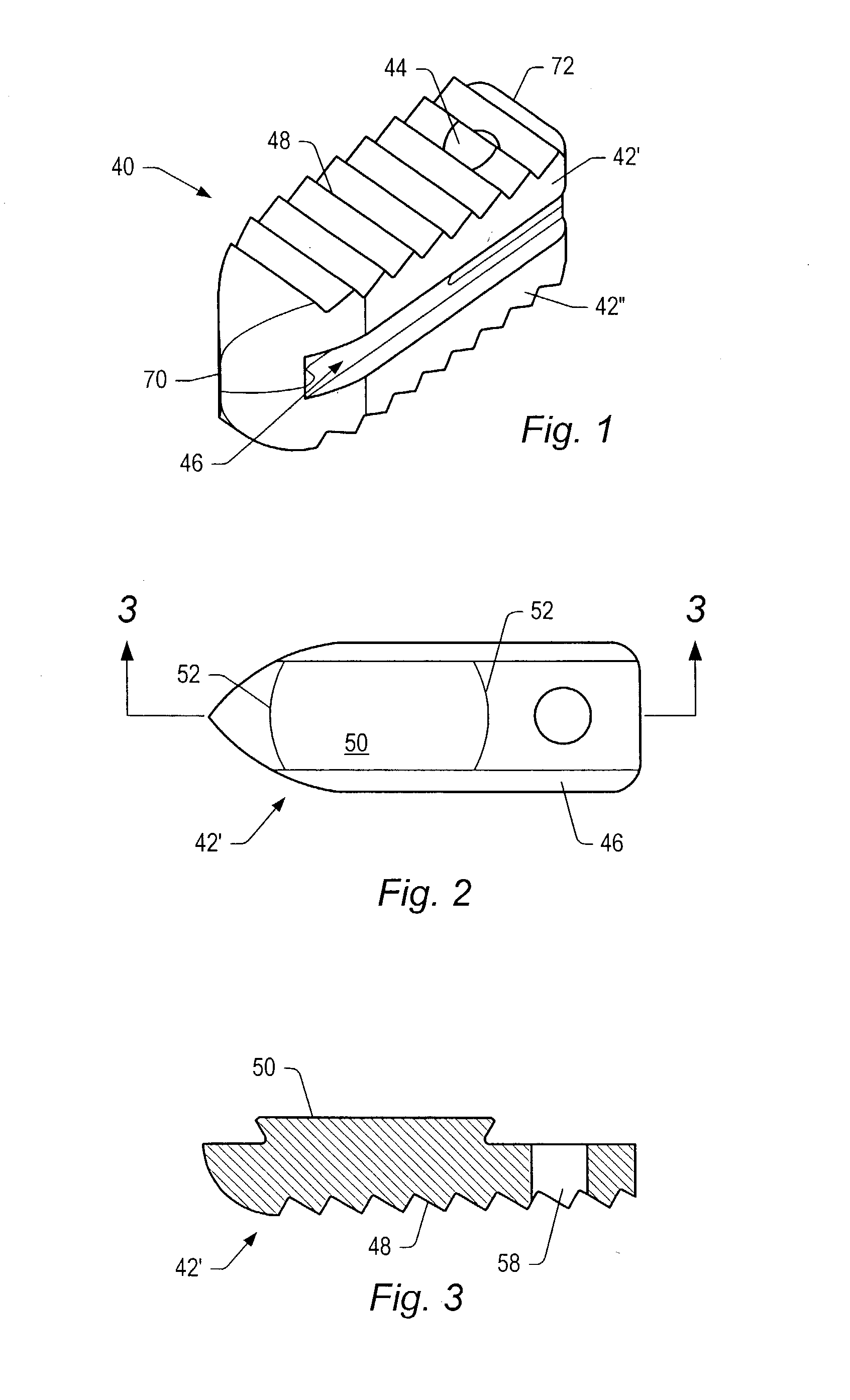 Spinal implant