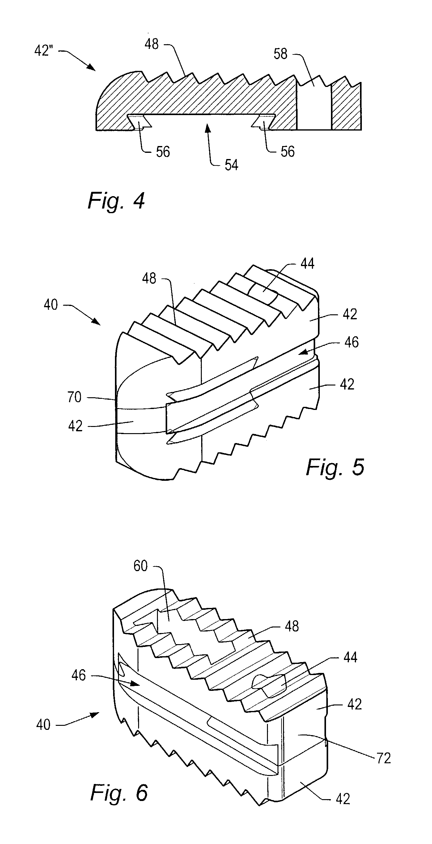 Spinal implant