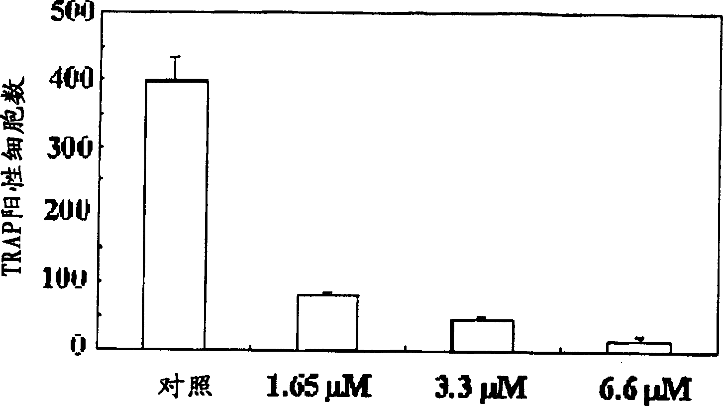 A process for preparing N-acylated lysophosphatidylcholine compounds and a pharmaceutical composition for treatment of metabolic bone disease comprising said compounds