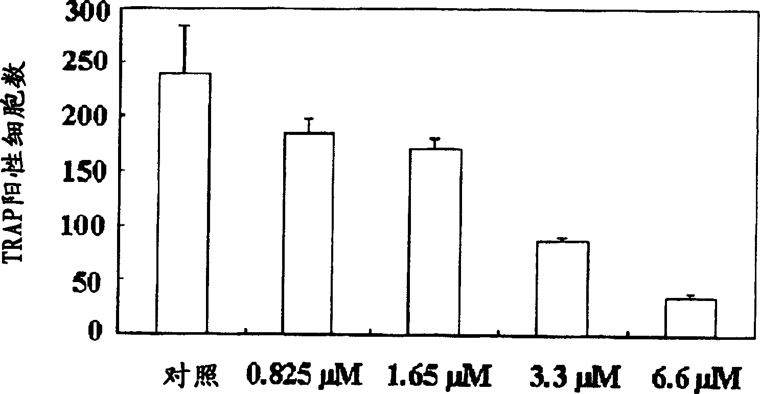 A process for preparing N-acylated lysophosphatidylcholine compounds and a pharmaceutical composition for treatment of metabolic bone disease comprising said compounds