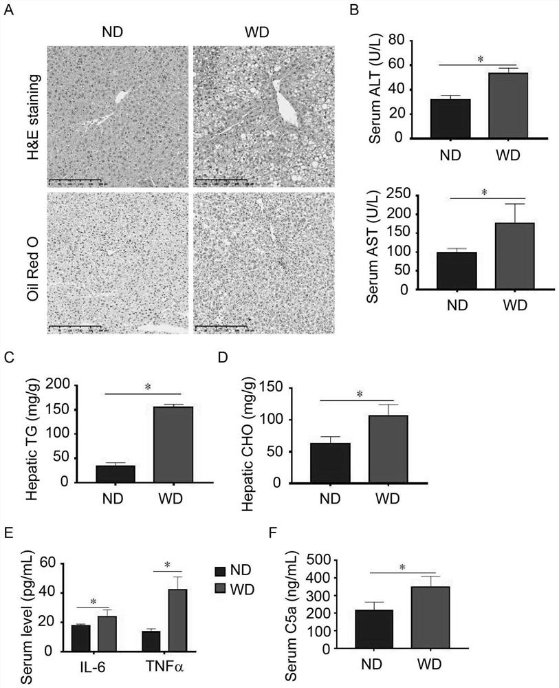 Application of PMX-53 polypeptide in preparation of medicine for treating non-alcoholic steatohepatitis