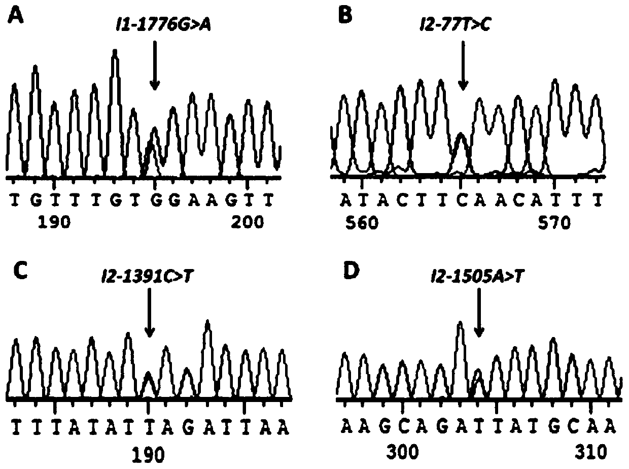 Application of ANGPTL5 gene as bovine backfat thickness molecular marker and detection method