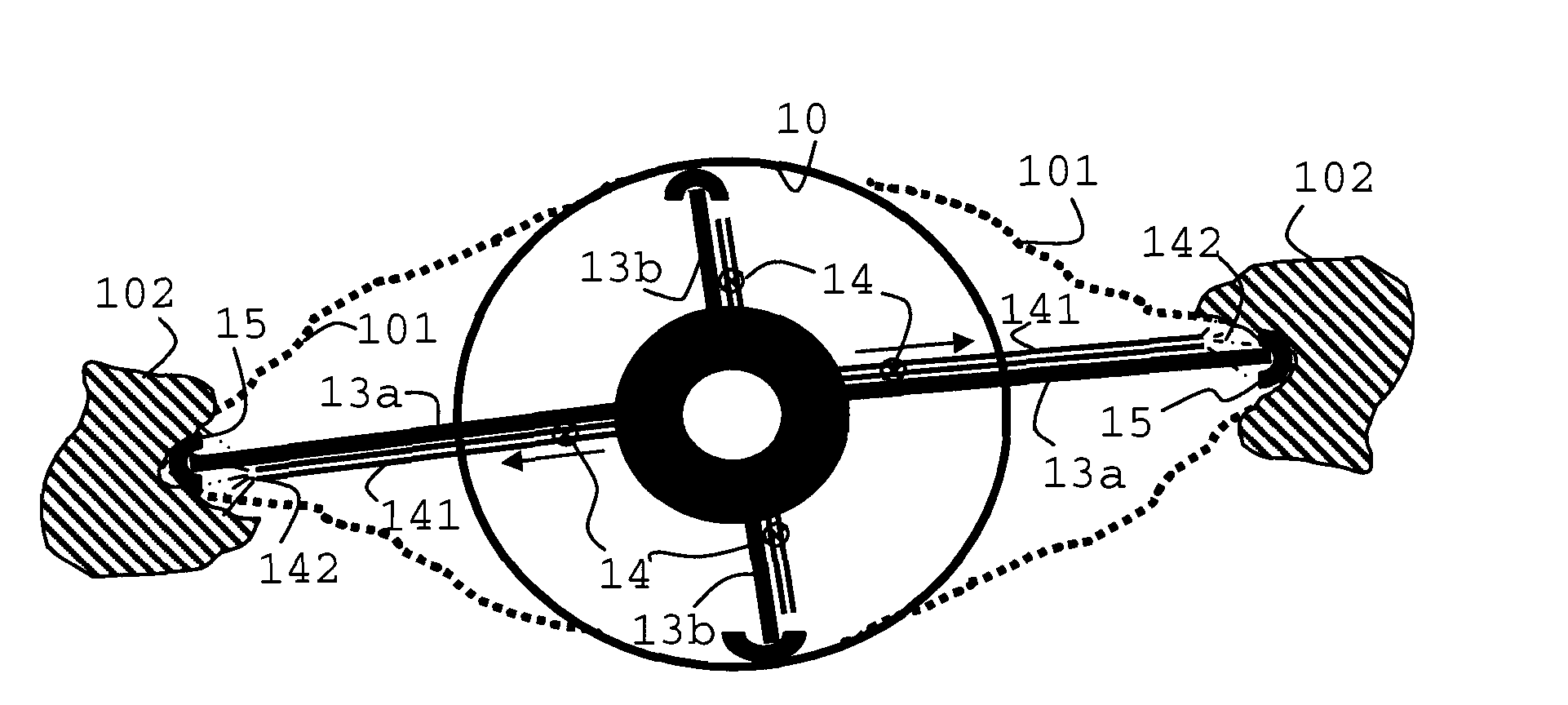 Wellbore treatment apparatus and method