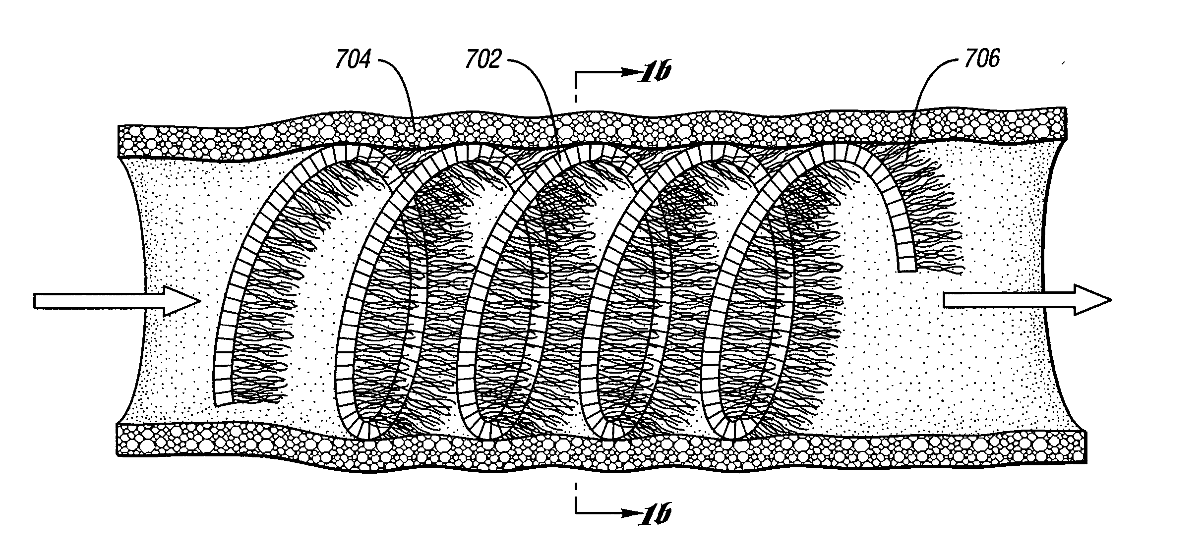 Occluding device and method of occluding fluid flow through a body vessel