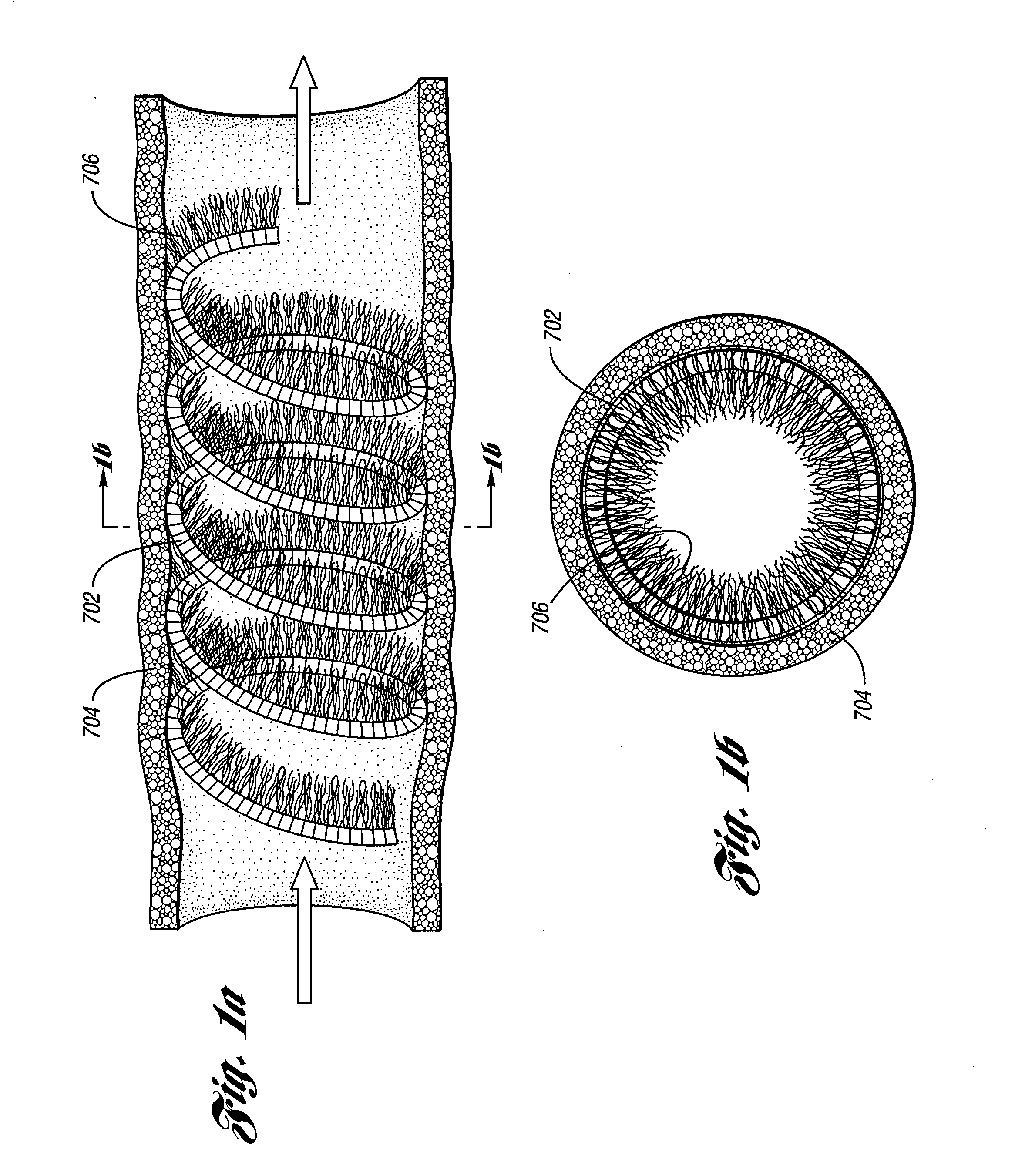 Occluding device and method of occluding fluid flow through a body vessel