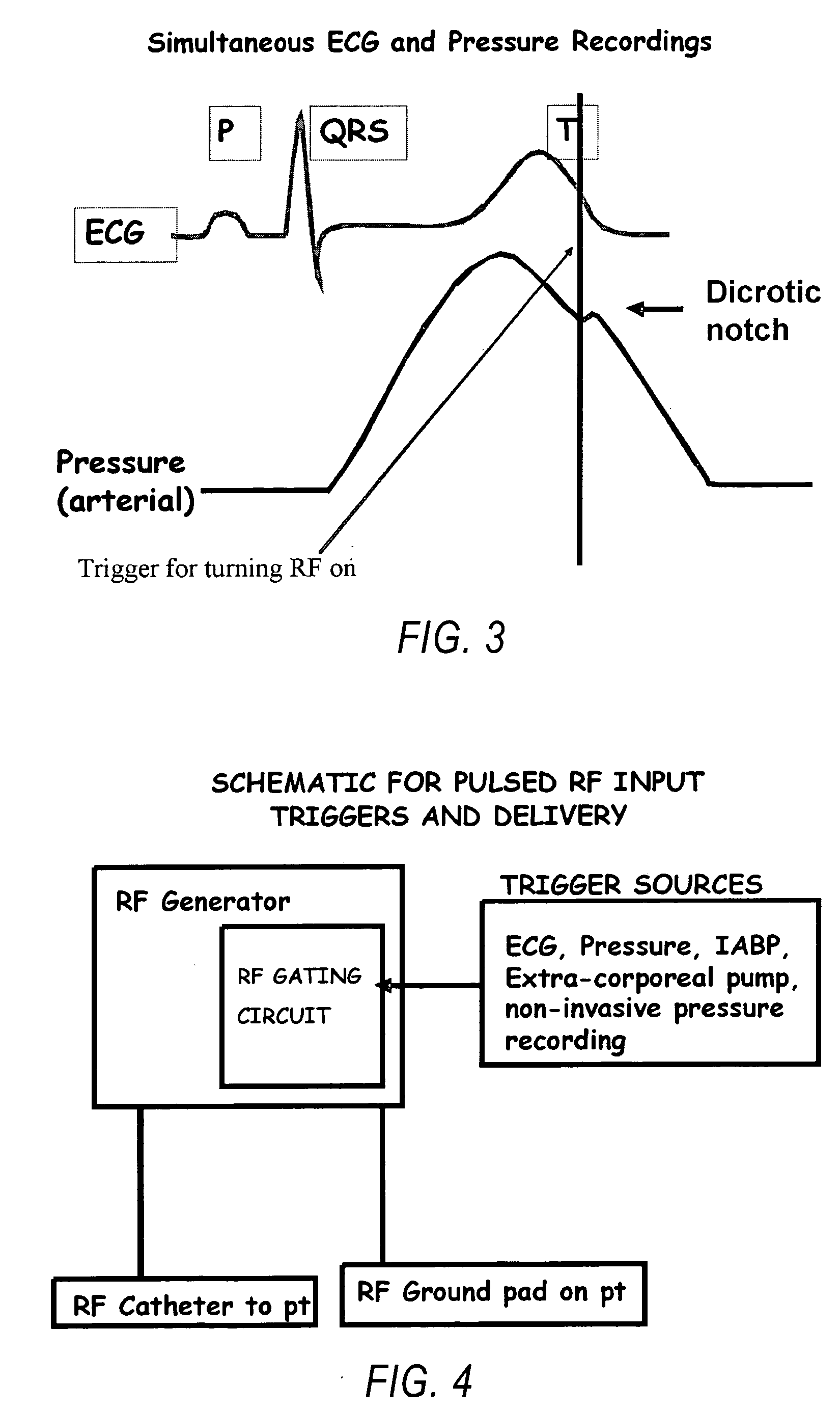 Methods and systems for gated or pulsed application of ablative energy in the treatment of cardiac disorders