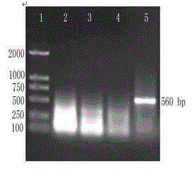 cDNA full-length sequence of paralichthys olivaceus mode recognition receptor TLR8 and application thereof