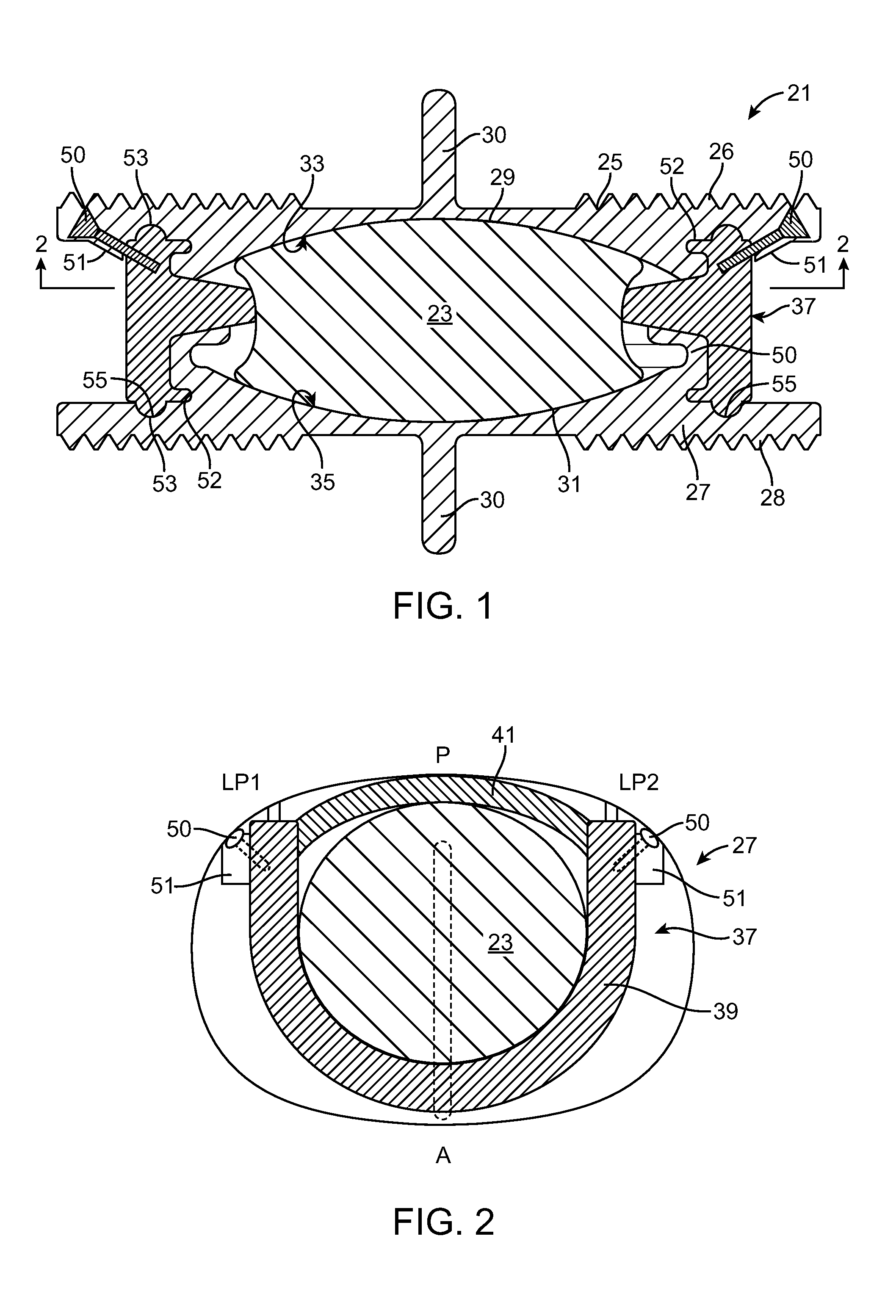 Motion Limiting Insert For An Artificial Intervertebral Disc