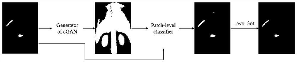 Bone scan image hot spot segmentation method, system, medium and device