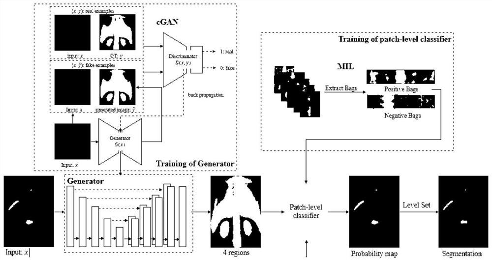 Bone scan image hot spot segmentation method, system, medium and device