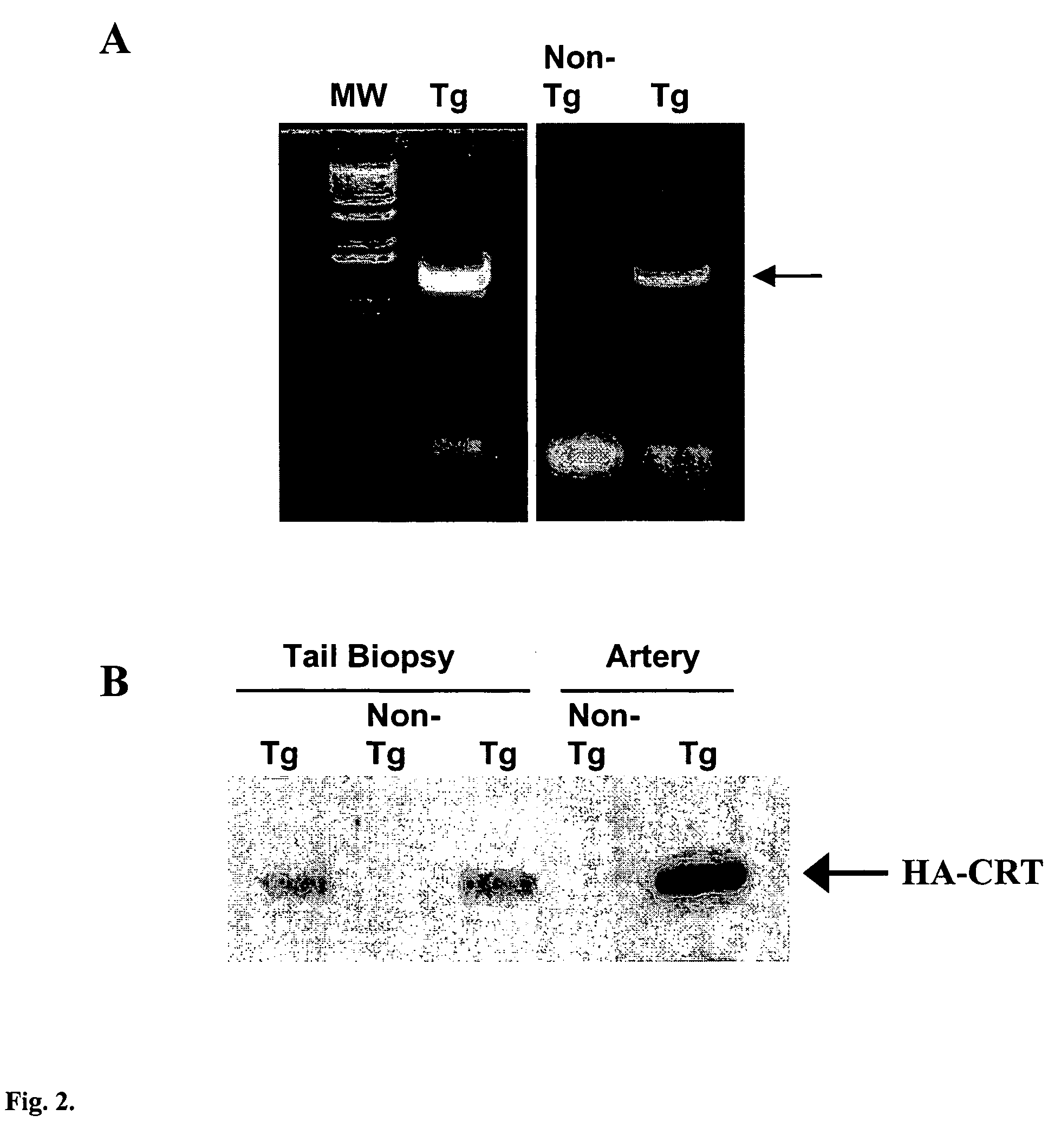 Transgenic mouse over-expressing calreticulin (CRT) in vascular smooth muscle cells