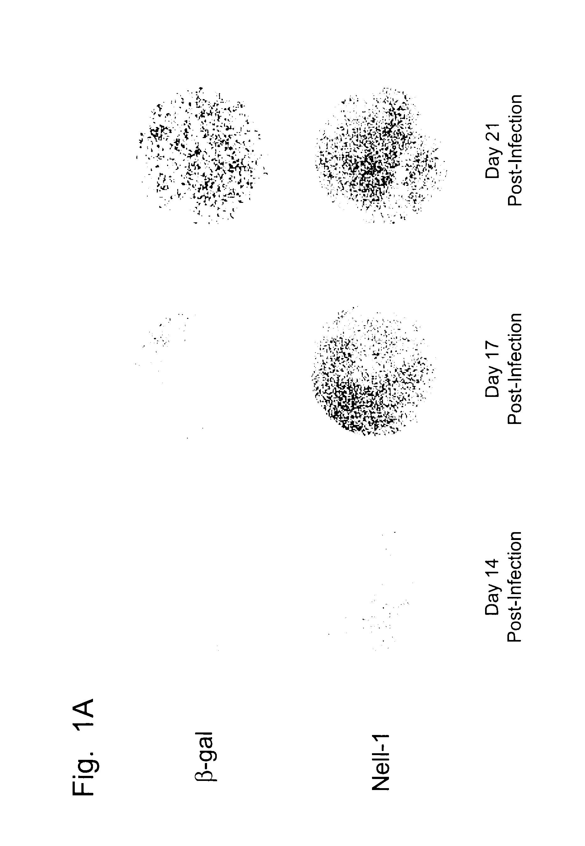 NELL-1 enhanced bone mineralization