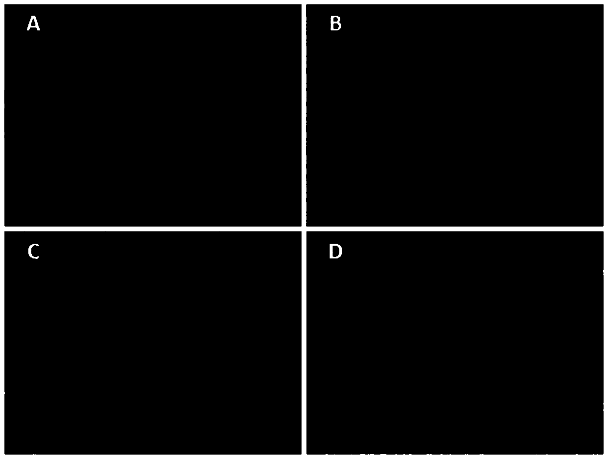 Preparation method of dental pulp stem cells (DPSCs)