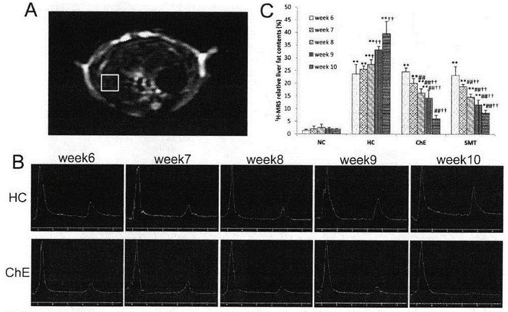 Application of cyclocarya paliurus effective part in preparation of medicine used for treating non-alcoholic fatty liver disease