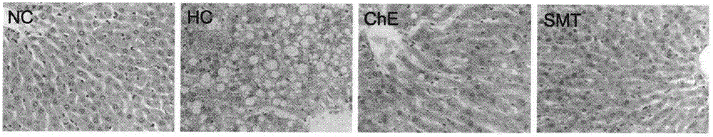 Application of cyclocarya paliurus effective part in preparation of medicine used for treating non-alcoholic fatty liver disease