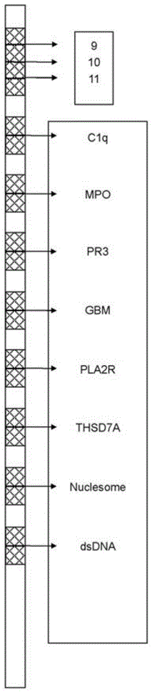 Immunoblotting kit for detecting autoimmune nephrosis and preparation method thereof