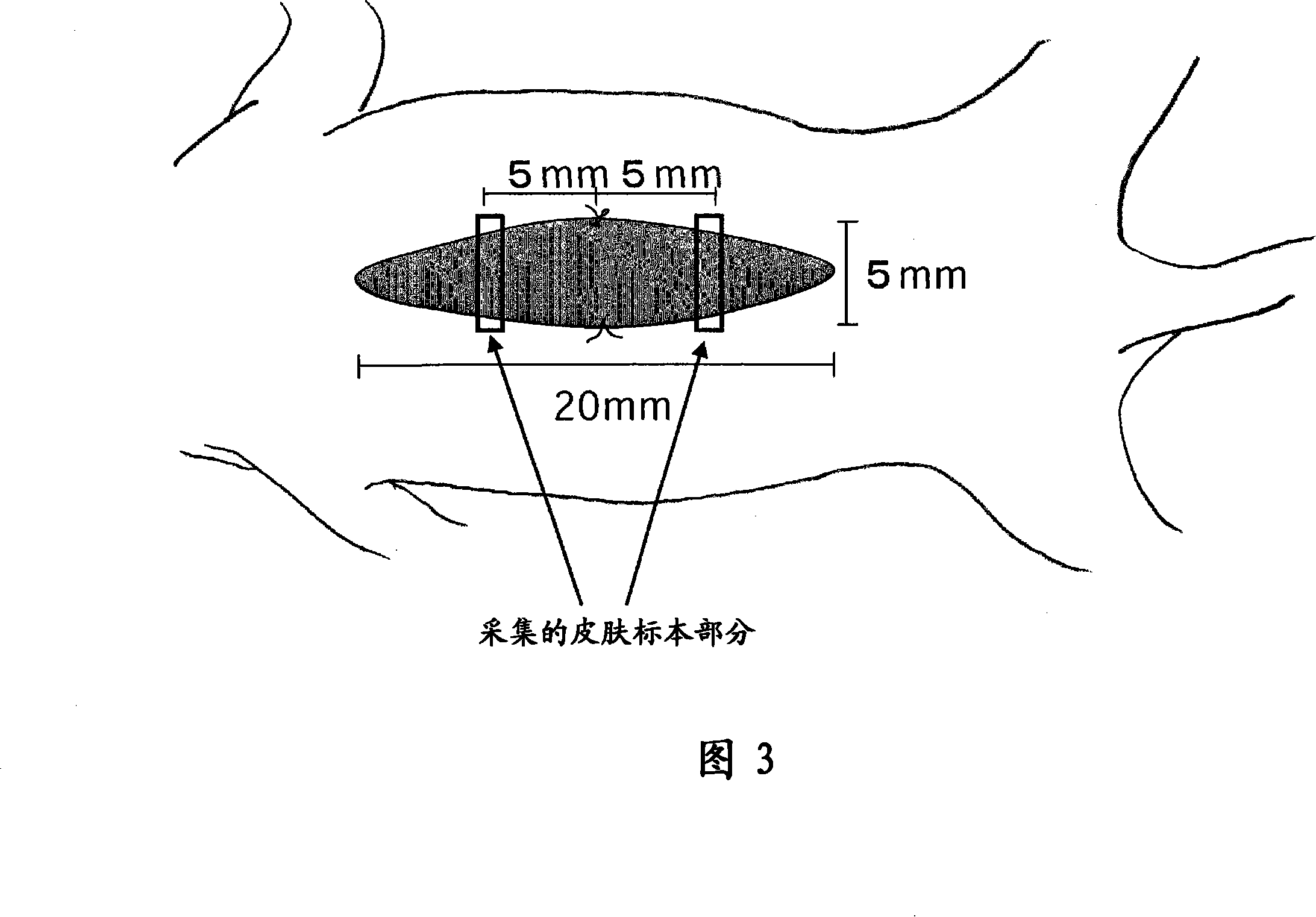 Collagen produced accelerant, dressing material, and method for producing collagen