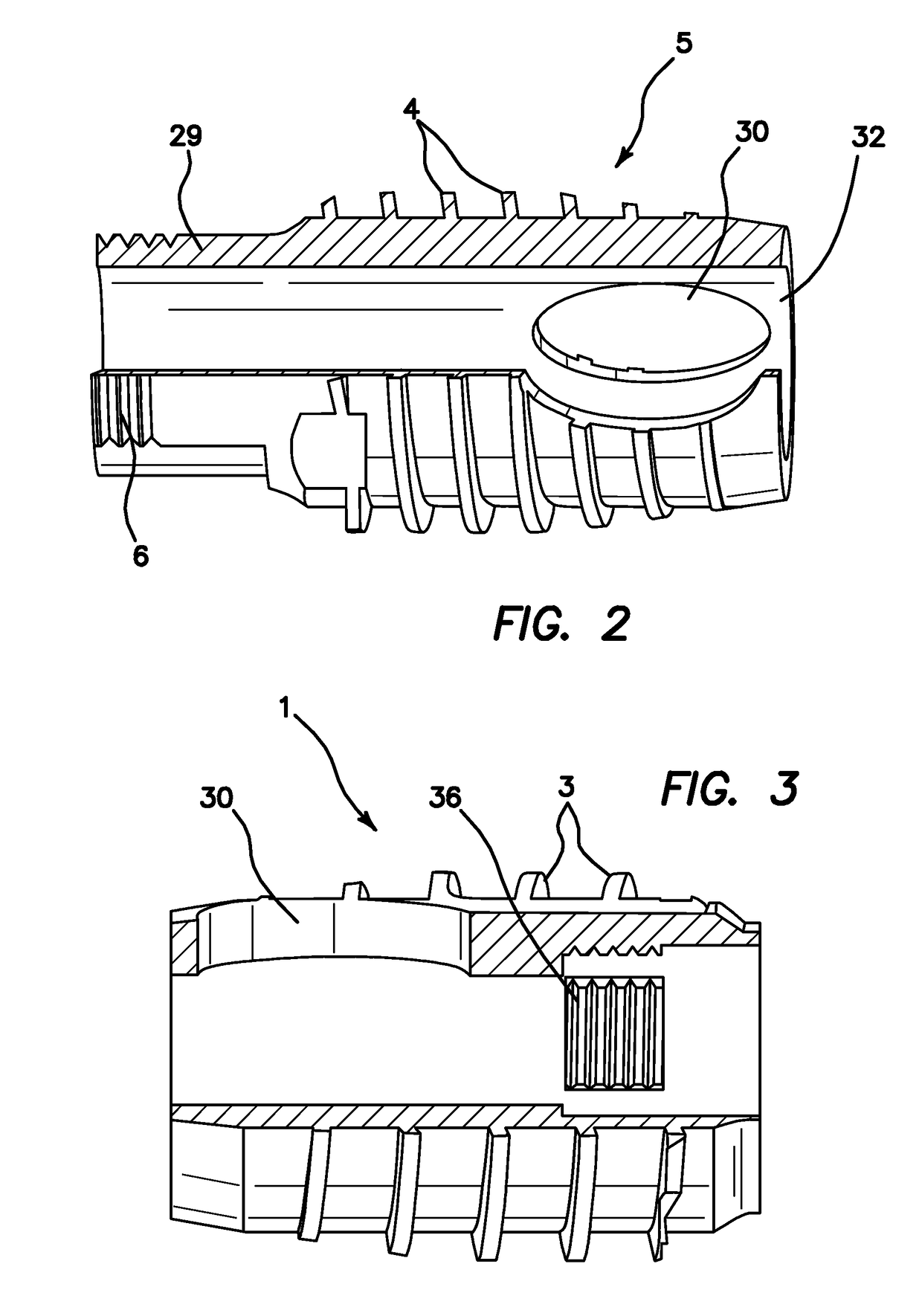 Apparatus and method for use in the treatment of hammertoe