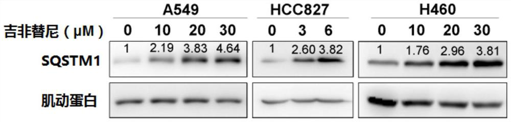 A kind of egfr kinase inhibitor and its application in preparing anticancer drugs