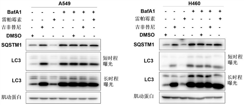 A kind of egfr kinase inhibitor and its application in preparing anticancer drugs