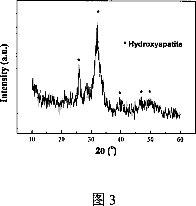 Hollow ball shaped nanometer hydroxylapatite material and the preparing method