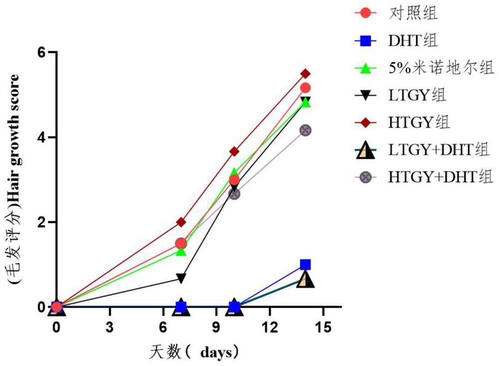 Application of gastrodia elata and uncaria beverage in prevention and treatment of alopecia seborrhoeica and preparation method of gastrodia elata and uncaria beverage extract