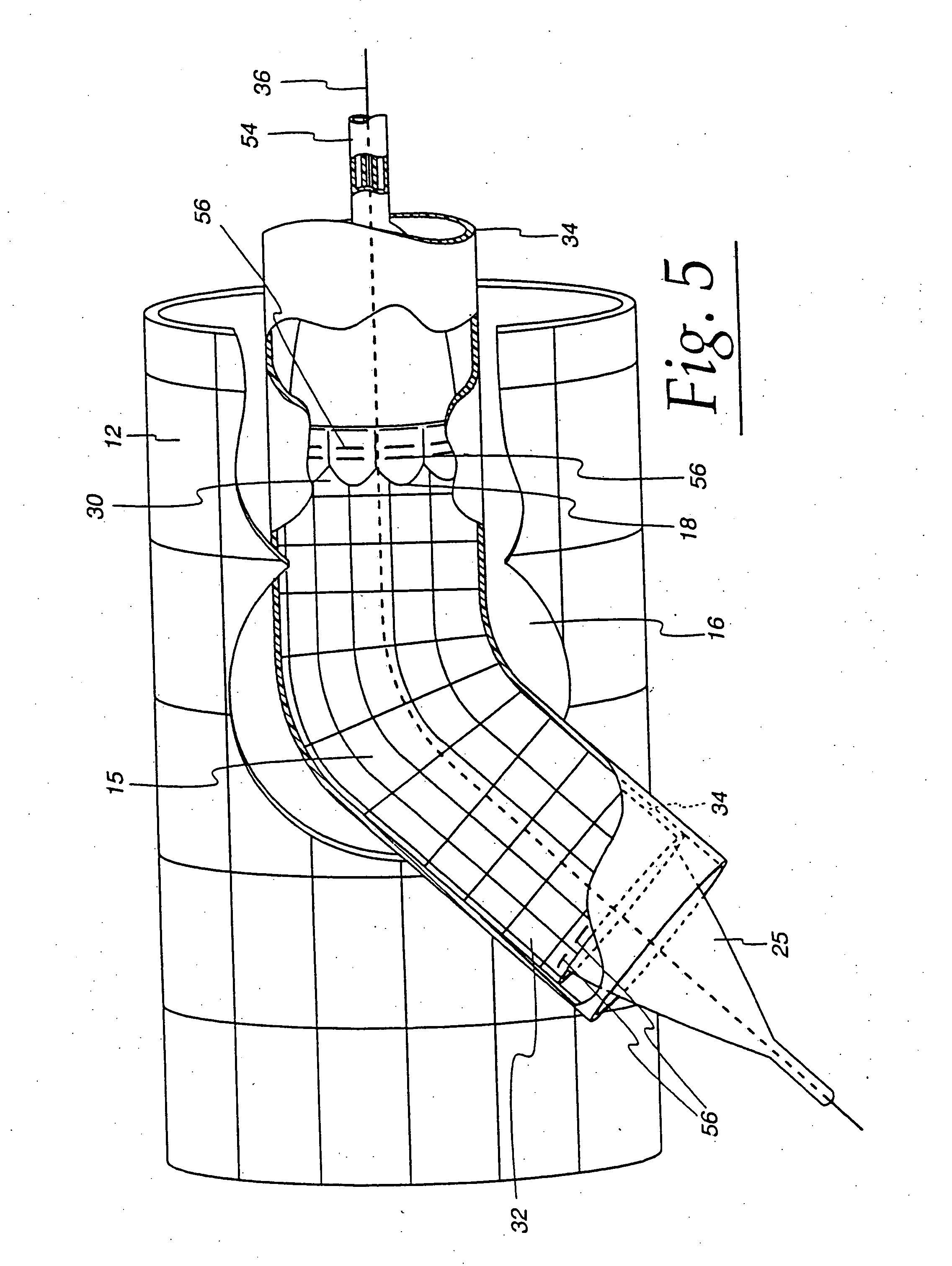 Extendible stent apparatus