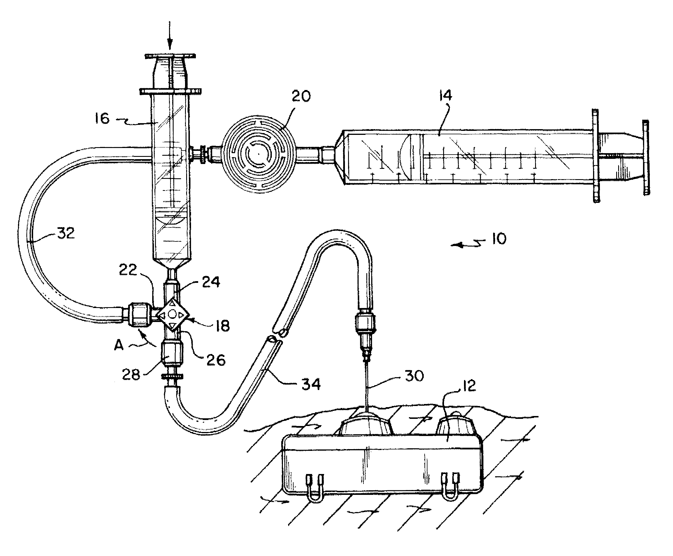 Refill kit for an implantable pump