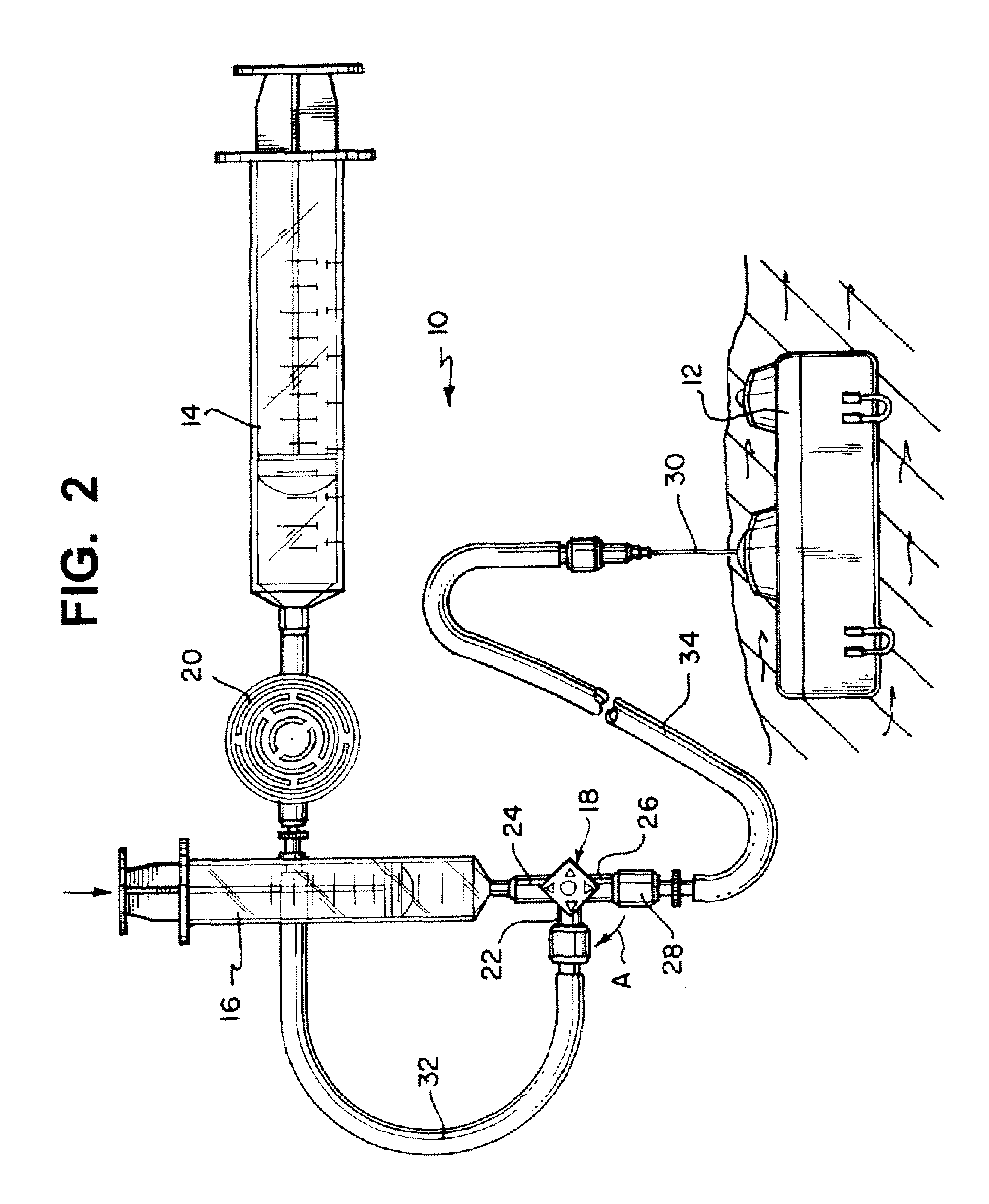 Refill kit for an implantable pump