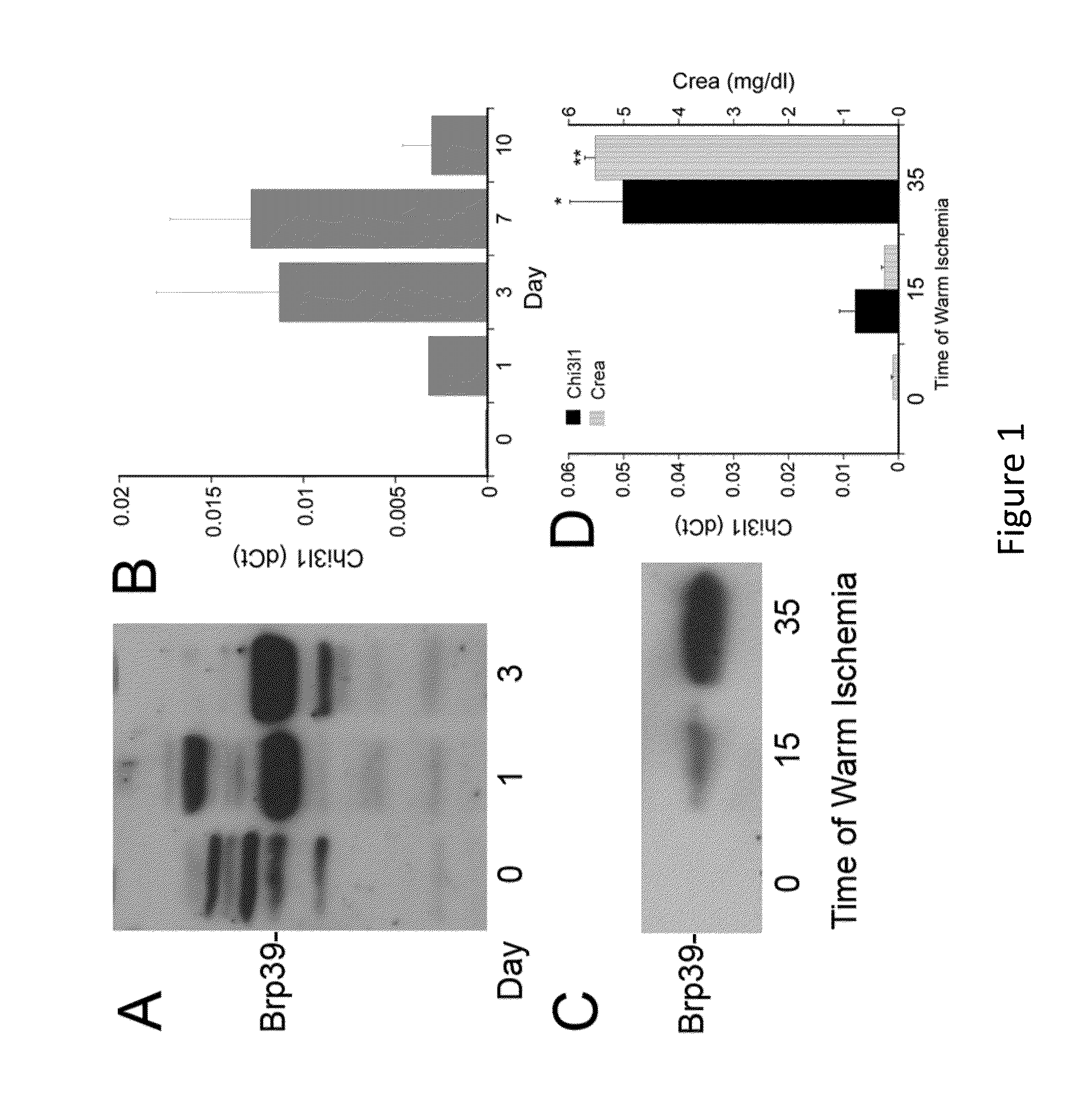 Chitinase-3-Like Protein 1 as a Biomarker of Recovery from Kidney Injury