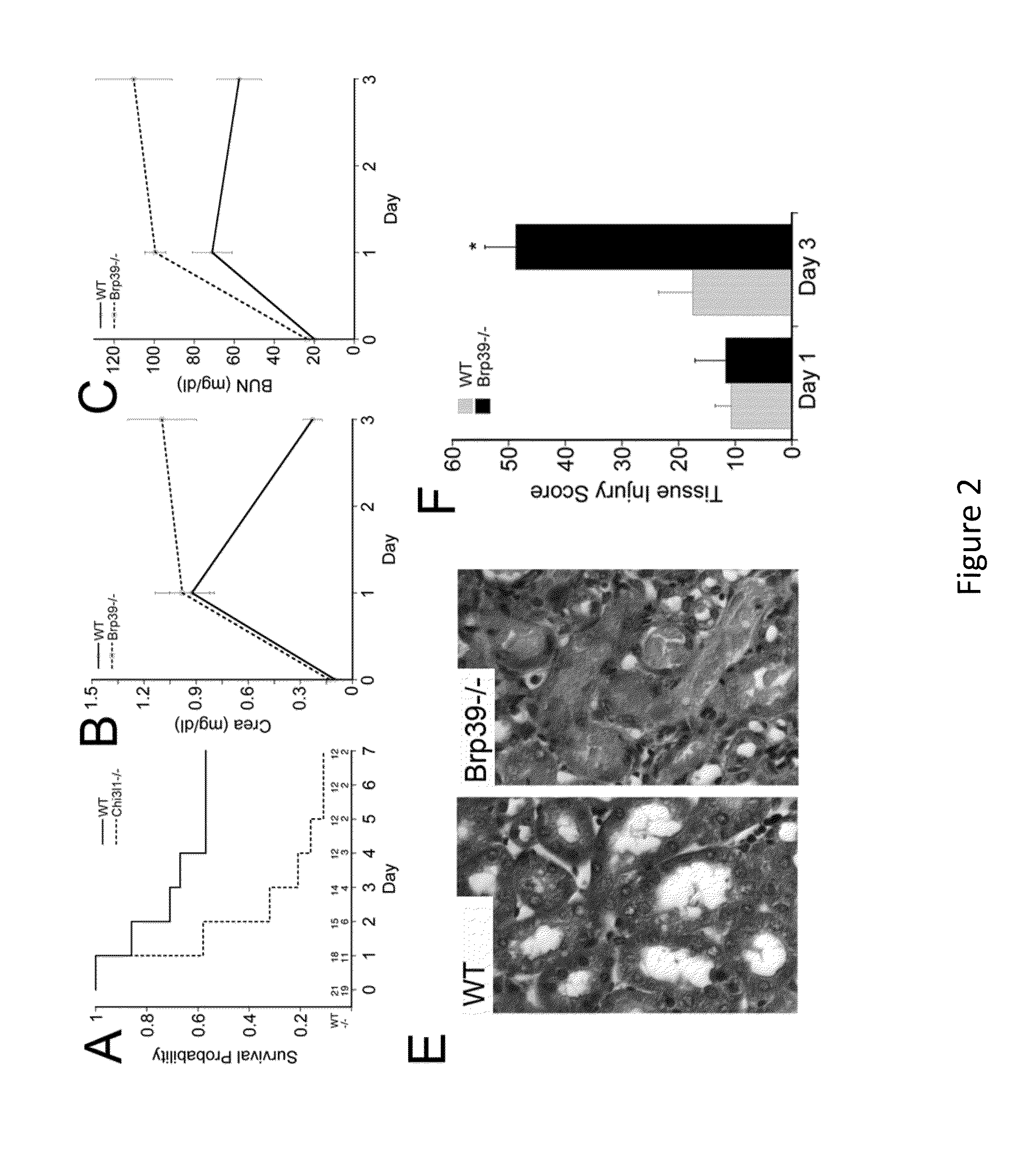 Chitinase-3-Like Protein 1 as a Biomarker of Recovery from Kidney Injury