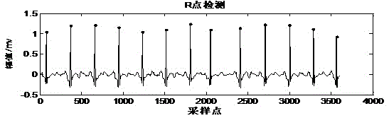 Real-time electrocardiogramclassification method based on random projection