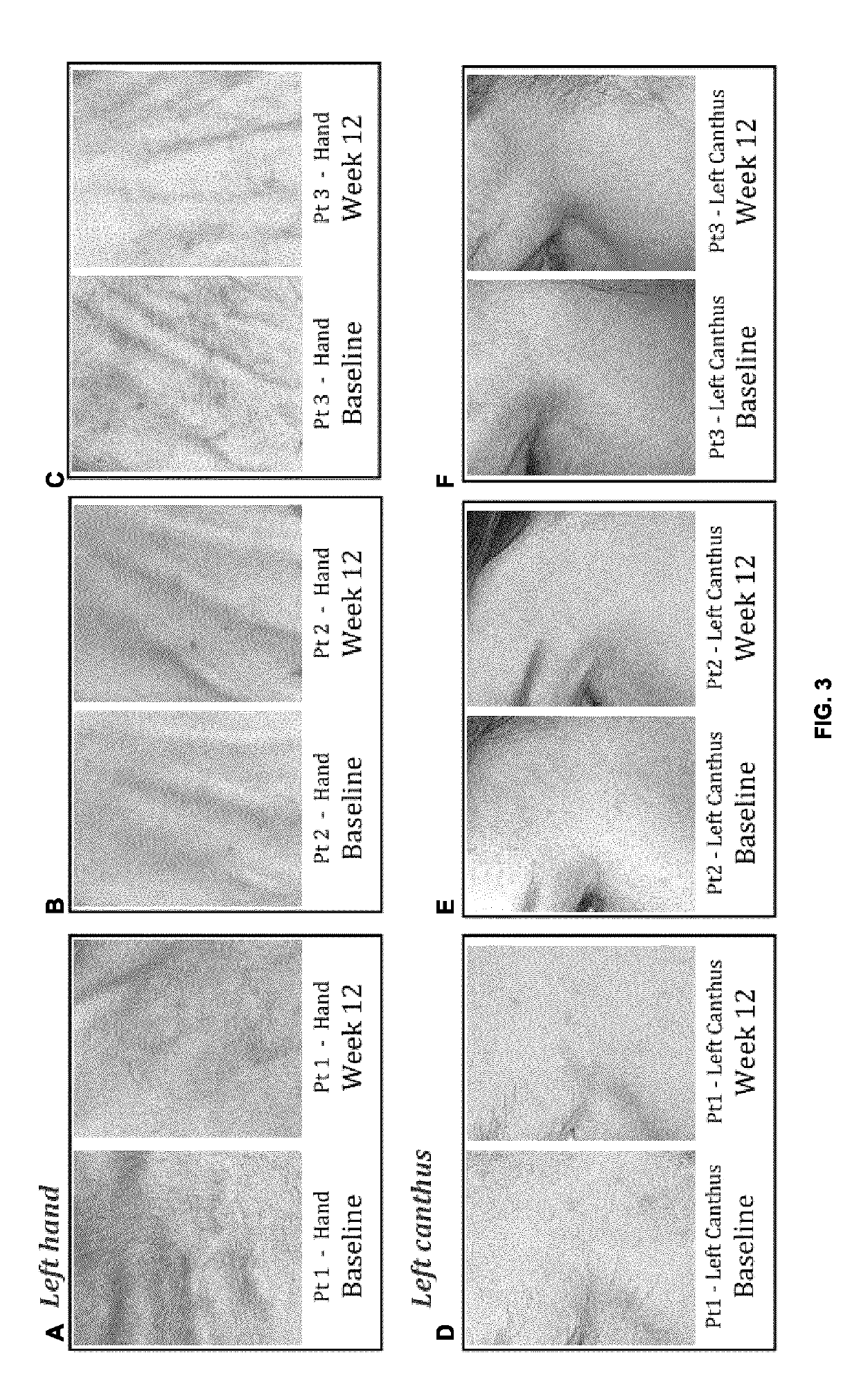 Putrescine slow-release topical formulations