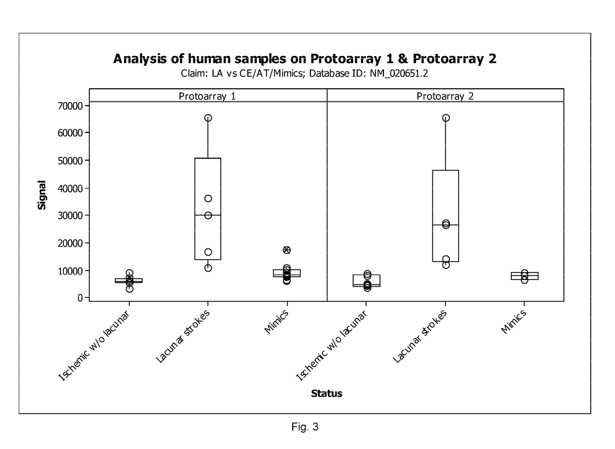 Method for Detection of Ischemic Strokes