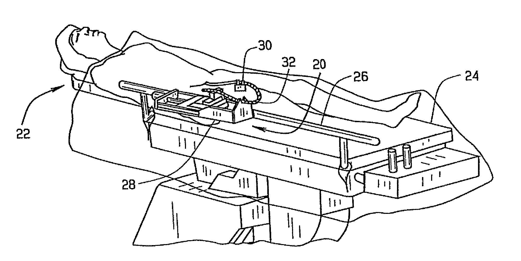 System and methods for advancing a catheter