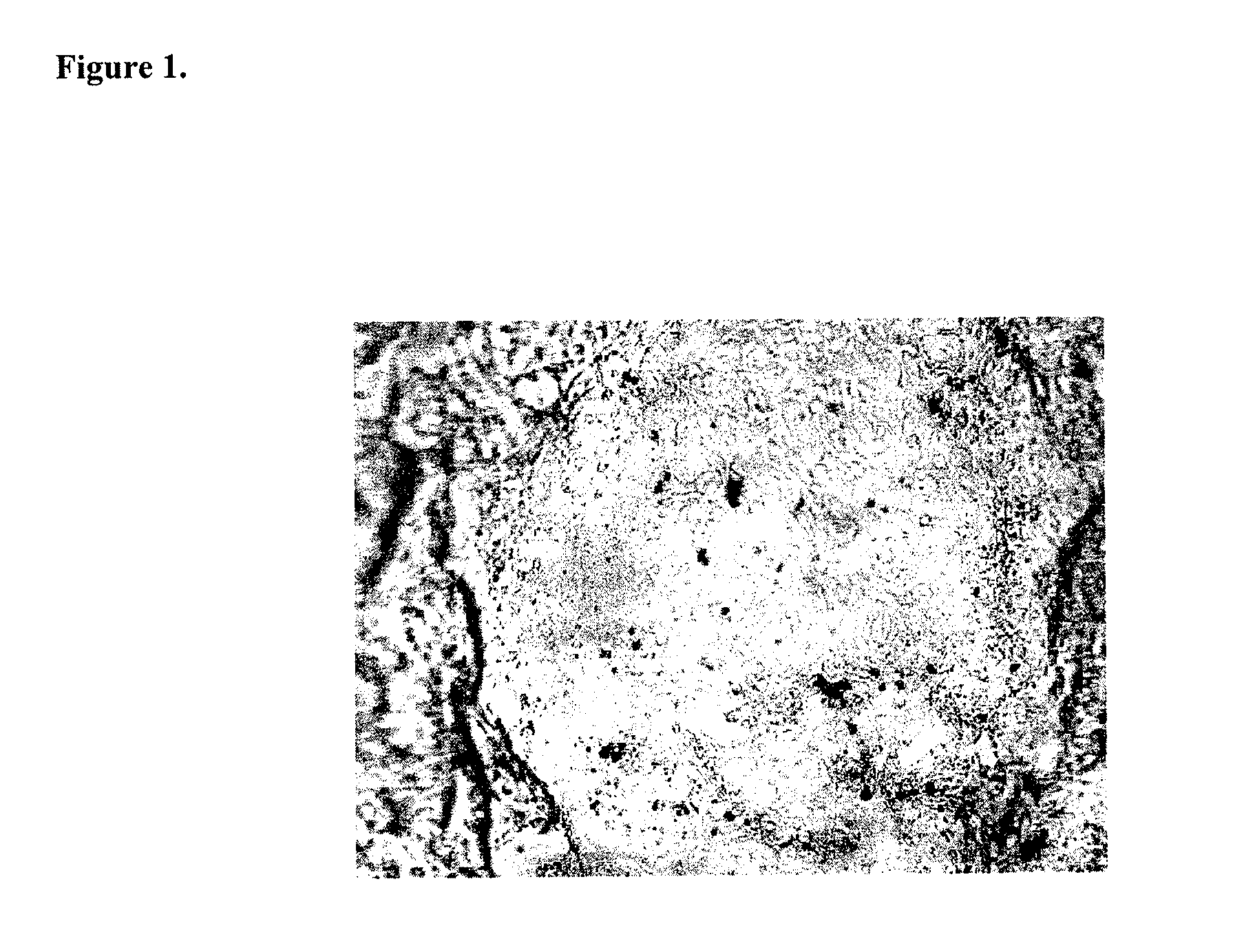 Treatment of presbyopia with alpha- picolinic acid and its analogs