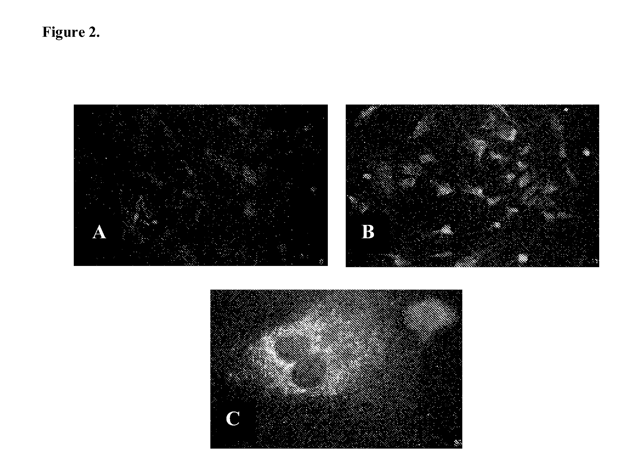 Treatment of presbyopia with alpha- picolinic acid and its analogs