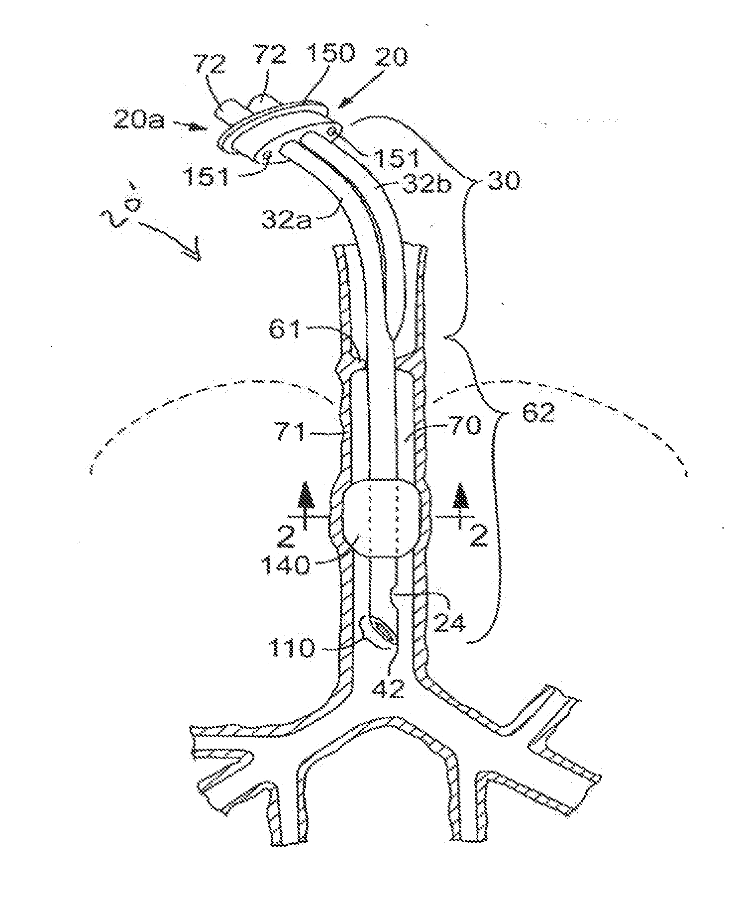 Secretion clearing patient airway management system