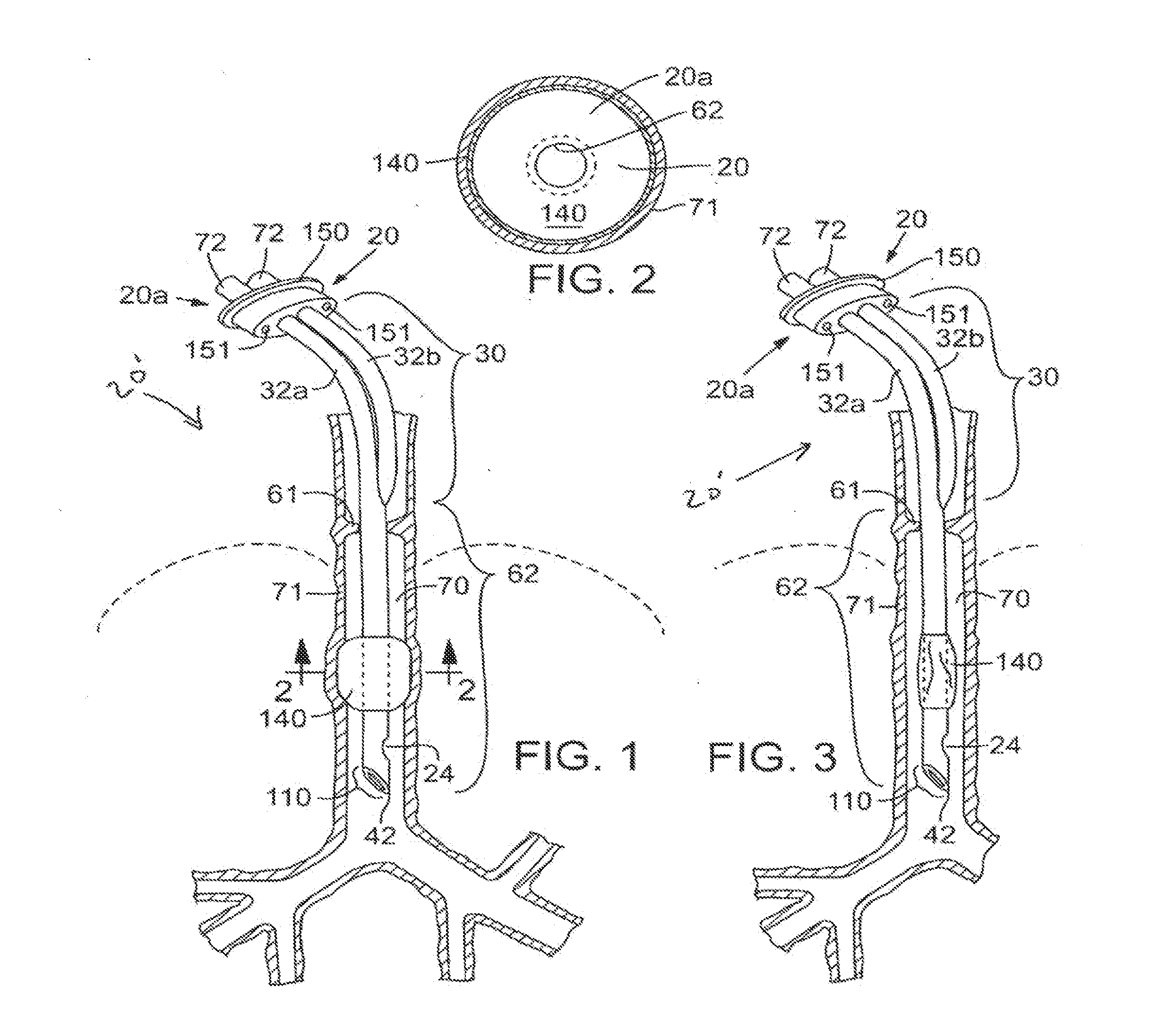 Secretion clearing patient airway management system