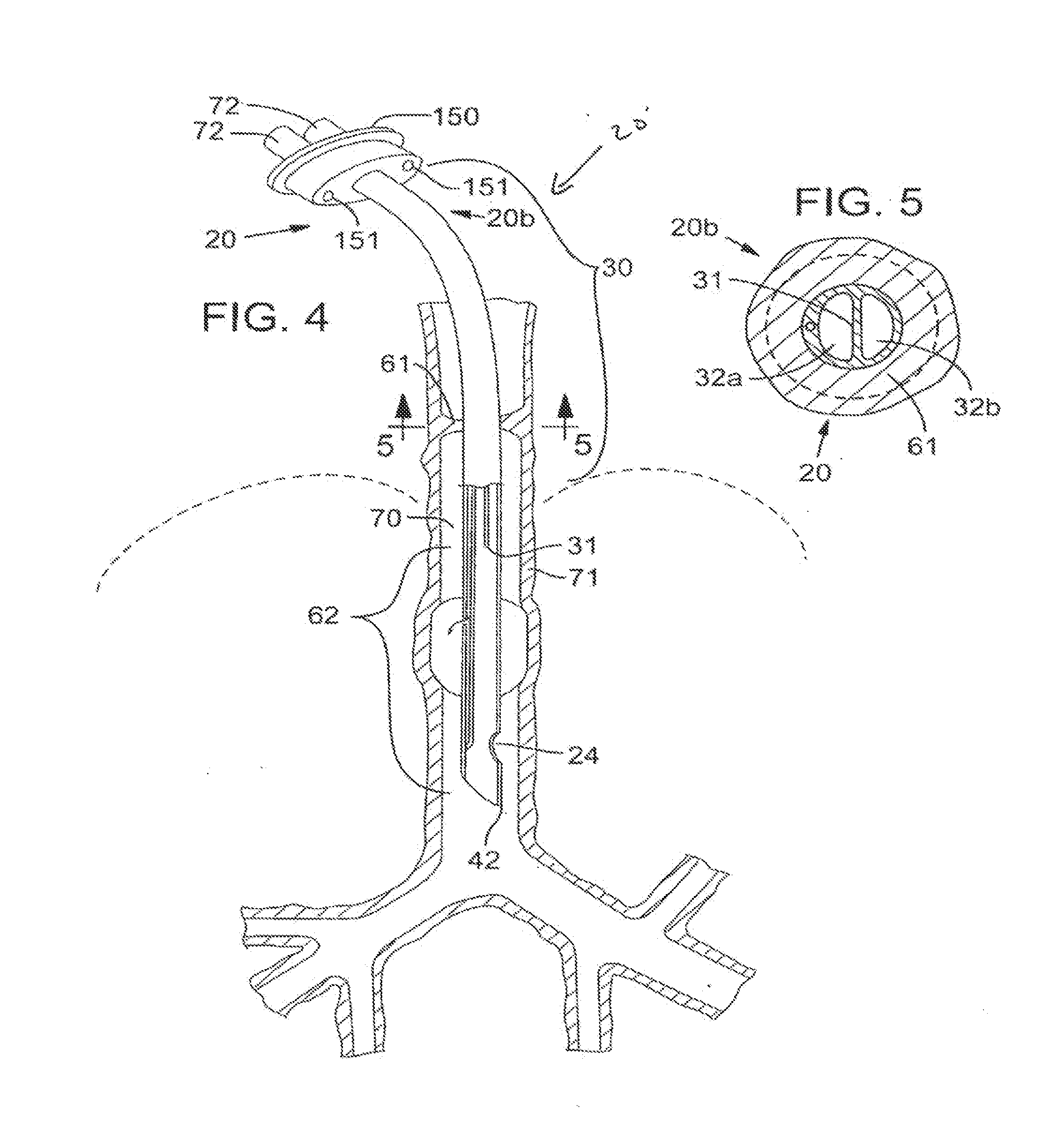 Secretion clearing patient airway management system