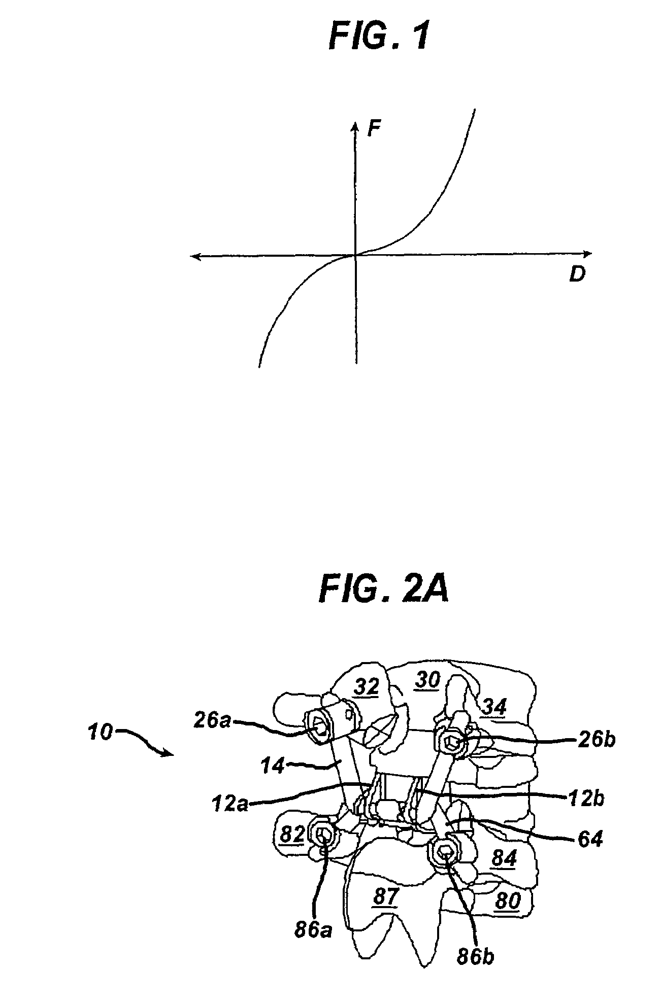 Non-linear artificial ligament system