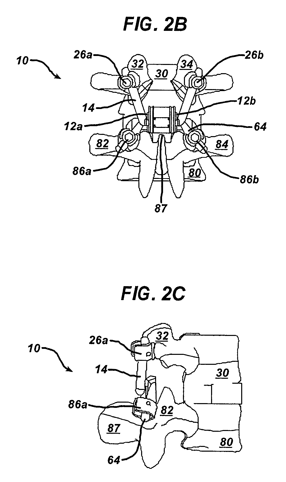 Non-linear artificial ligament system