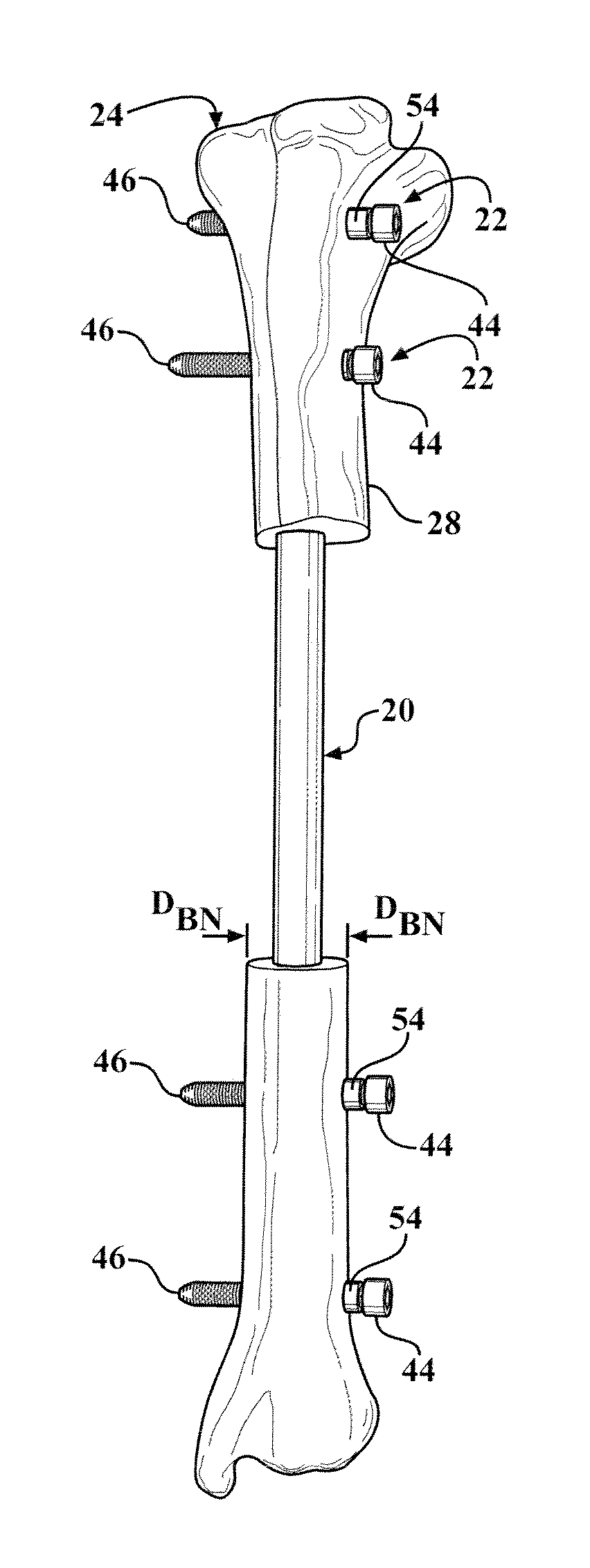 Easily implantable and stable nail-fastener for skeletal fixation and method