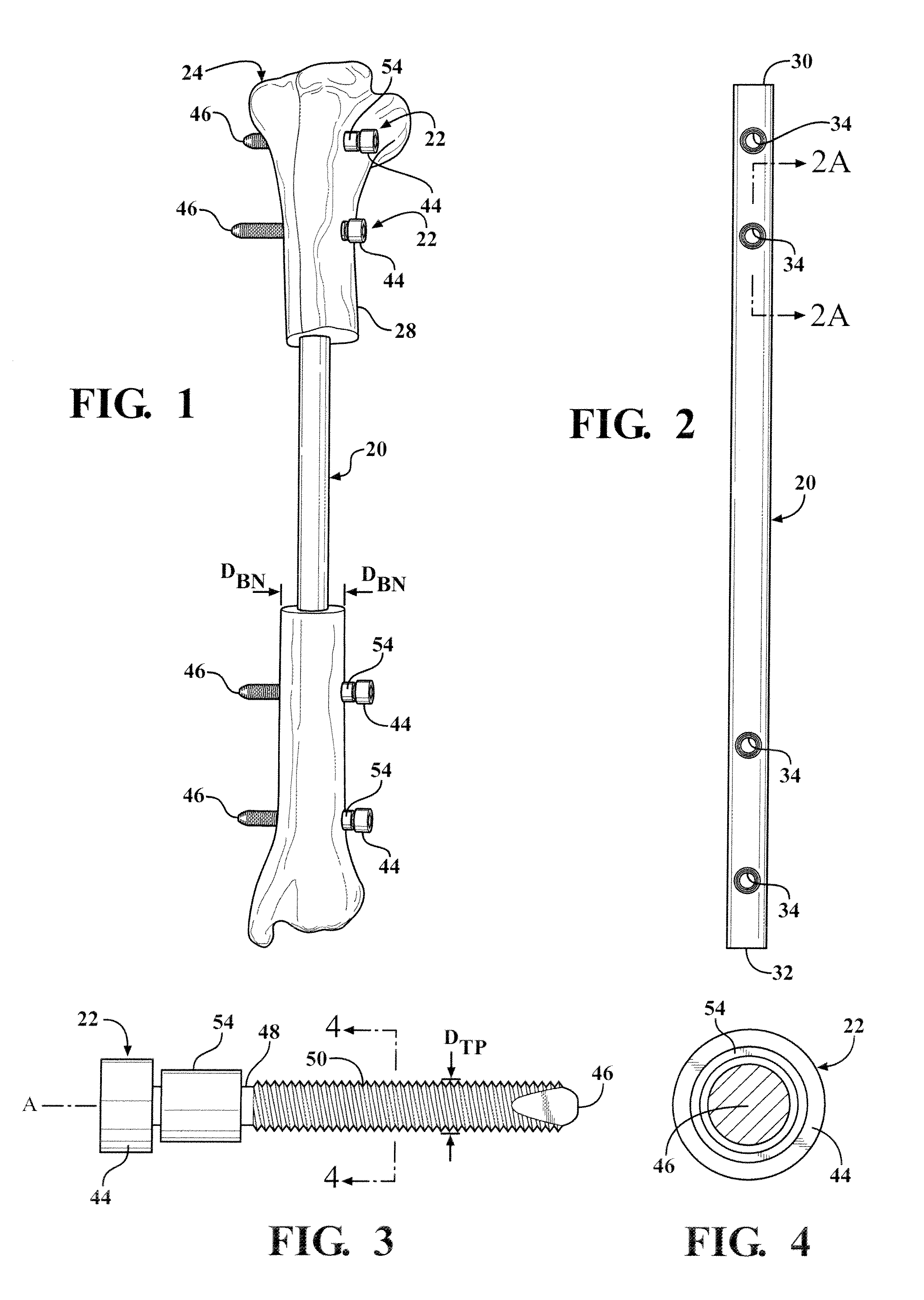 Easily implantable and stable nail-fastener for skeletal fixation and method