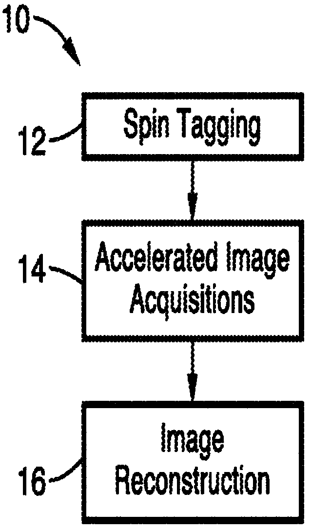 Noninvasive 4D time-resolved dynamic magnetic resonance angiography method