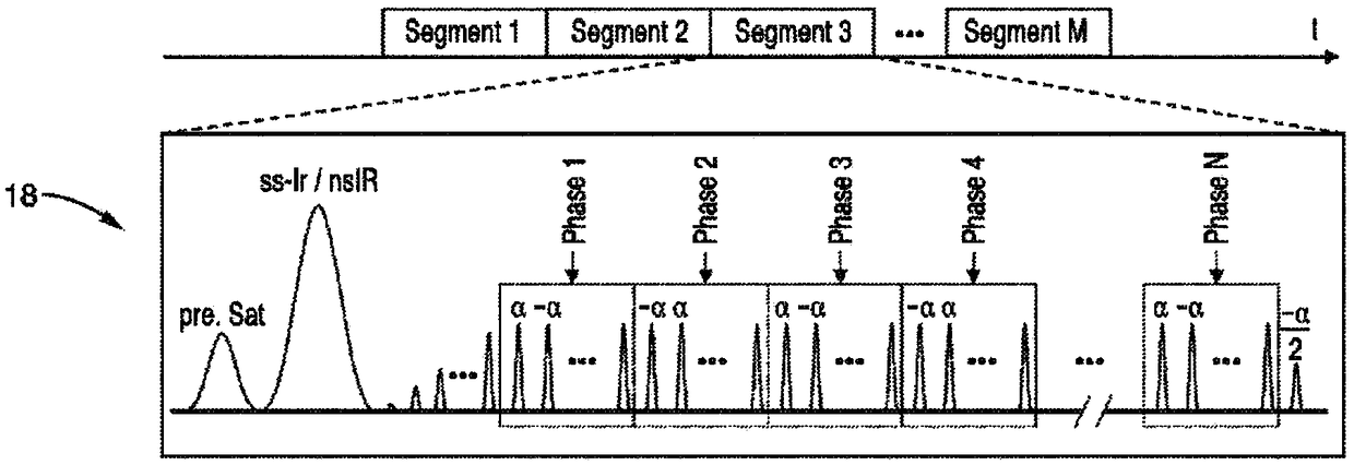 Noninvasive 4D time-resolved dynamic magnetic resonance angiography method