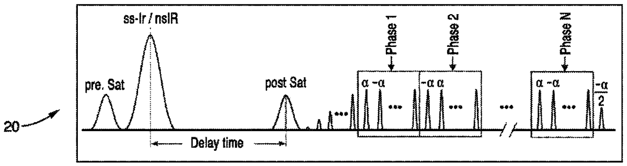 Noninvasive 4D time-resolved dynamic magnetic resonance angiography method