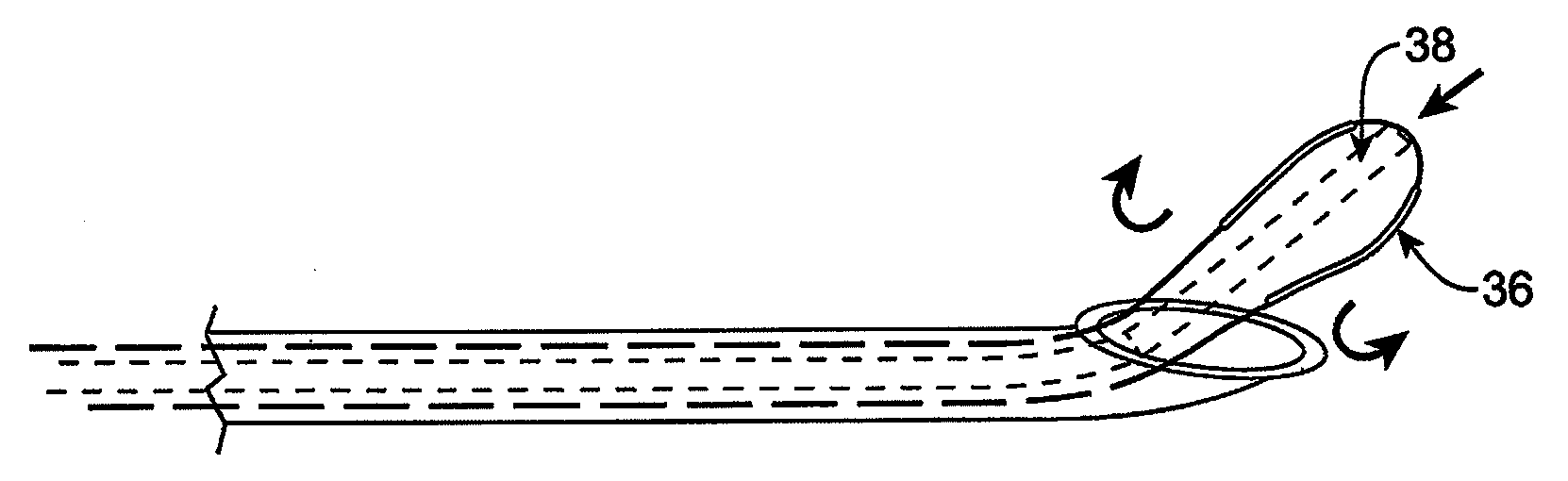 Devices and methods for selective surgical removal of tissue