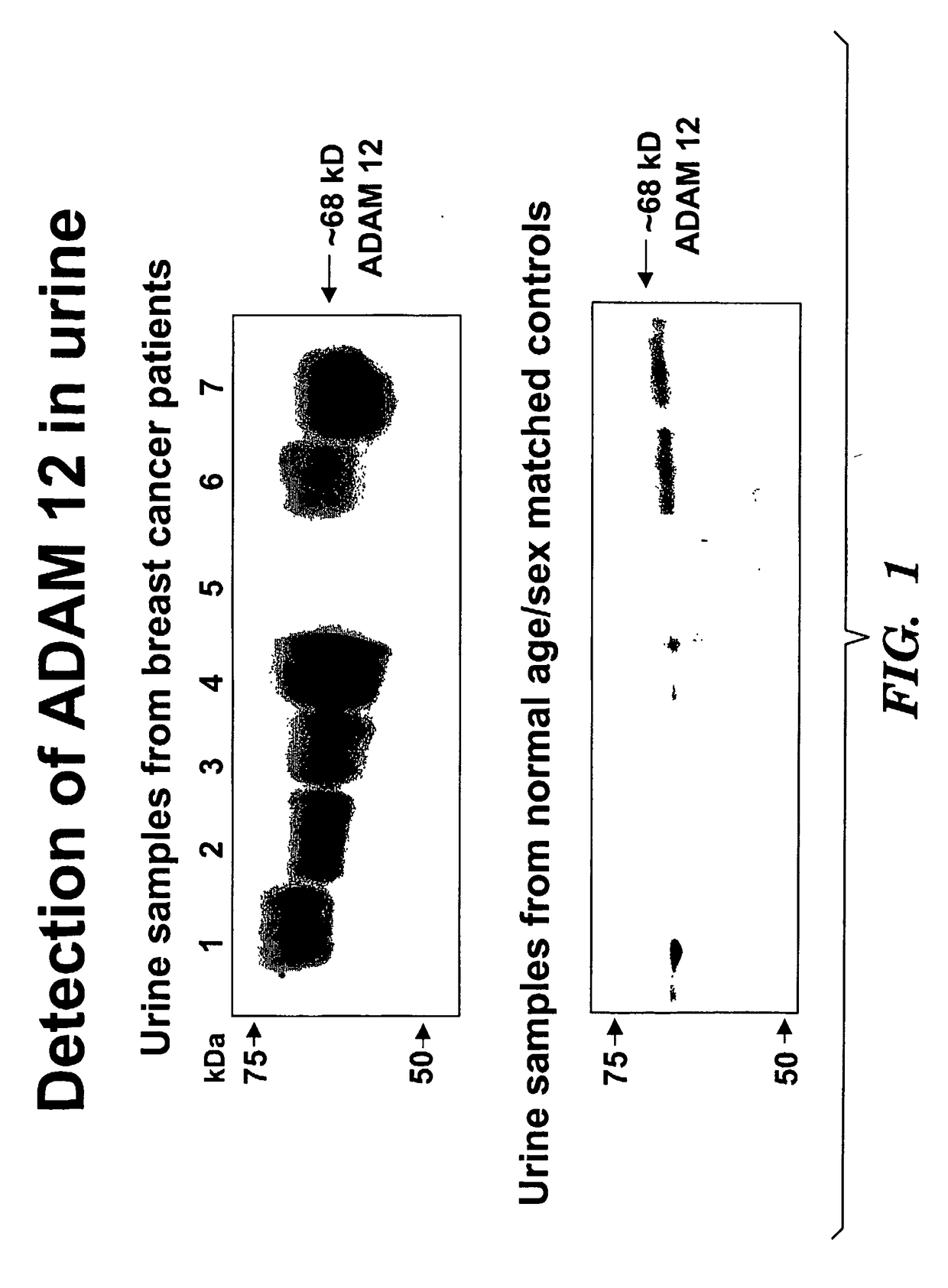 Methods for diagnosis and prognosis of cancers of epithelial origin