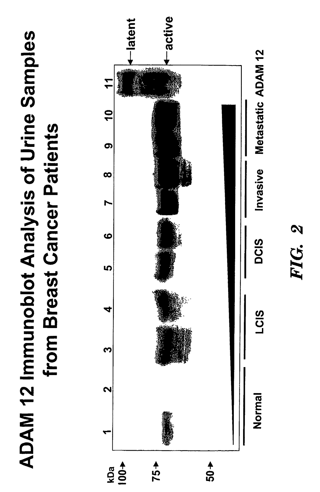 Methods for diagnosis and prognosis of cancers of epithelial origin